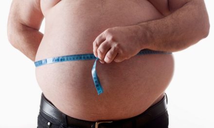 Kondisi Obesity Pada Perut Buncit Seseorang